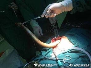 黄鳝门事件在线观看,网络暴力下的道德拷问与反思  第3张